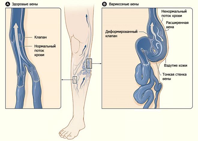 Angiologia