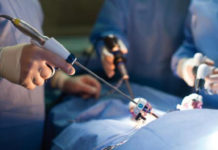 S I L S операции