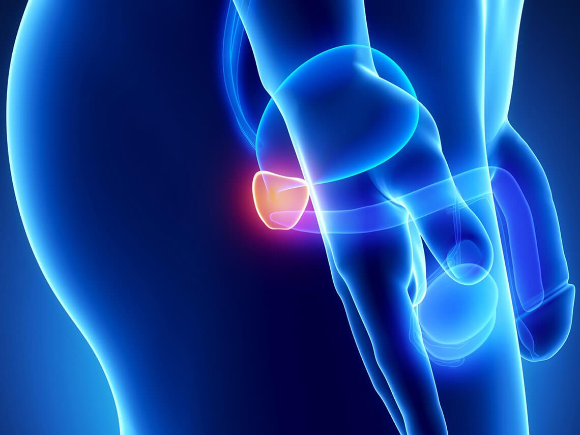 rezectie endoscopica prostata diagnosticul diferenţial al prostatitei acute