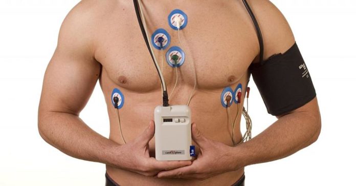 huge_холтеровское_мониторирование_экг